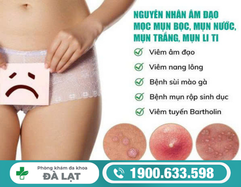 Hình ảnh minh họa